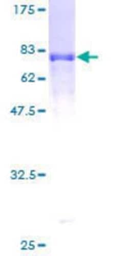 Novus Biologicals Recombinant Human Synaptotagmin 12 GST (N-Term) Protein:Proteínas