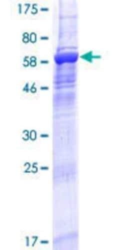 Novus Biologicals Recombinant Human CENPL GST (N-Term) Protein 10 &mu;g | Buy Online | Novus Biologicals&trade; | Fisher Scientific