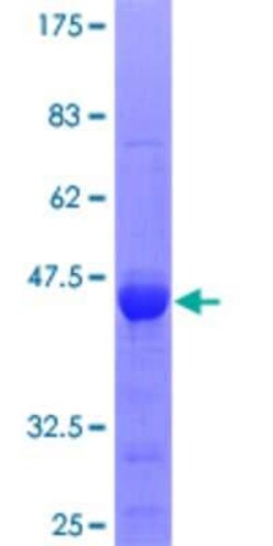 Novus Biologicals Recombinant Human LONRF1 GST (N-Term) Protein 25 &mu;g | Buy Online | Novus Biologicals&trade; | Fisher Scientific