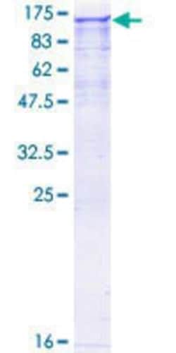 Novus Biologicals Recombinant Human NEK9 GST (N-Term) Protein 10 &mu;g | Buy Online | Novus Biologicals&trade; | Fisher Scientific