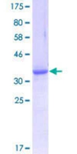 Novus Biologicals Recombinant Human NEK9 GST (N-Term) Protein 25 &mu;g | Buy Online | Novus Biologicals&trade; | Fisher Scientific