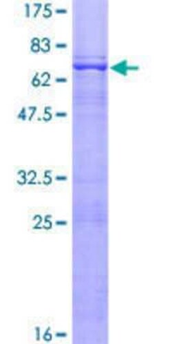 Novus Biologicals Recombinant Human CABLES1 GST (N-Term) Protein 25 &mu;g | Buy Online | Novus Biologicals&trade; | Fisher Scientific