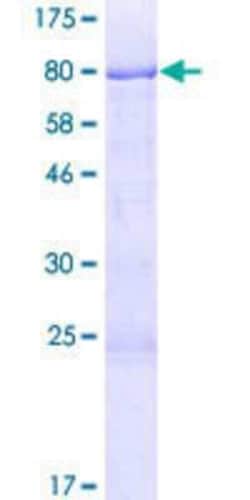 Novus Biologicals Recombinant Human CHMP7 GST (N-Term) Protein 10 &mu;g | Buy Online | Novus Biologicals&trade; | Fisher Scientific