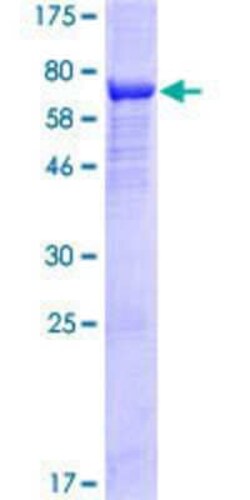 Novus Biologicals Recombinant Human ARRDC4 GST (N-Term) Protein 25 &mu;g | Buy Online | Novus Biologicals&trade; | Fisher Scientific