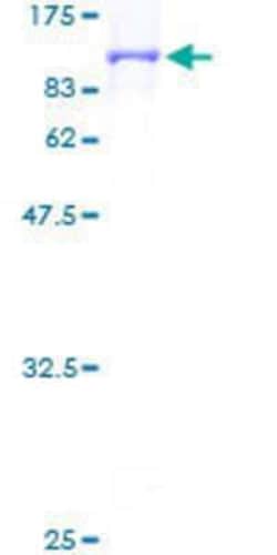 Novus Biologicals Recombinant Human COG7 GST (N-Term) Protein 25 &mu;g | Buy Online | Novus Biologicals&trade; | Fisher Scientific