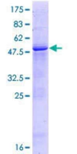 Novus Biologicals Recombinant Human GGTLC1 GST (N-Term) Protein 25 &mu;g | Buy Online | Novus Biologicals&trade; | Fisher Scientific