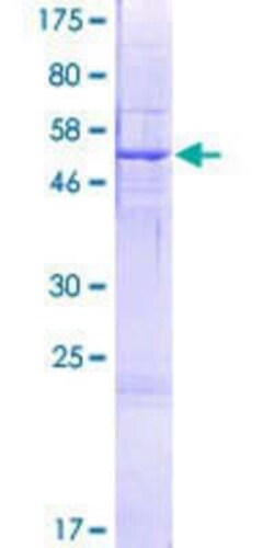 Novus Biologicals Recombinant Human OXNAD1 GST (N-Term) Protein 2 &mu;g | Buy Online | Novus Biologicals&trade; | Fisher Scientific