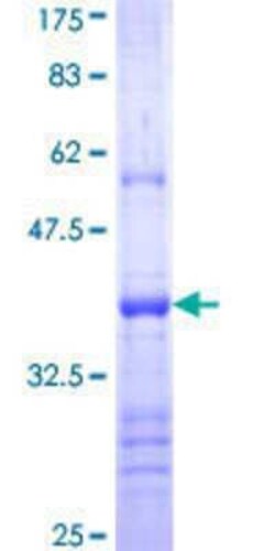 Novus Biologicals Recombinant Human Protocadherin 21 GST (N-Term) Protein 25 &mu;g | Buy Online | Novus Biologicals&trade; | Fisher Scientific