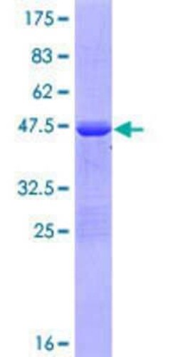 Novus Biologicals Recombinant Human RCSD 1 GST (N-Term) Protein 25 &mu;g | Buy Online | Novus Biologicals&trade; | Fisher Scientific