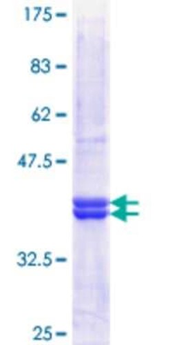Novus Biologicals Recombinant Human Gonadotropin Inducible Transcription Repressor 1 GST (N-Term) Protein 10 &mu;g | Buy Online | Novus Biologicals&trade; | Fisher Scientific