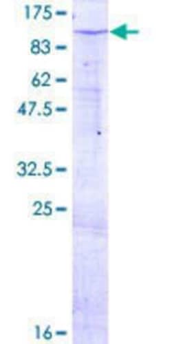 Novus Biologicals Recombinant Human ZNF585B GST (N-Term) Protein 25 &mu;g | Buy Online | Novus Biologicals&trade; | Fisher Scientific