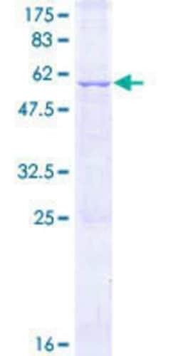 Novus Biologicals Recombinant Human SPSB4 GST (N-Term) Protein 25 &mu;g | Buy Online | Novus Biologicals&trade; | Fisher Scientific
