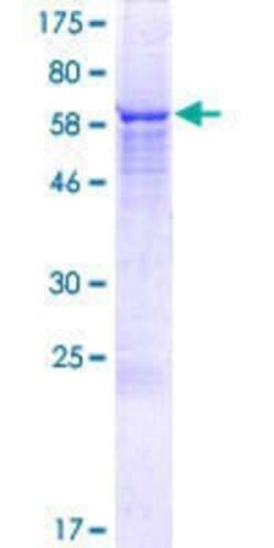 Novus Biologicals Recombinant Human MGC13138 GST (N-Term) Protein 25 &mu;g | Buy Online | Novus Biologicals&trade; | Fisher Scientific