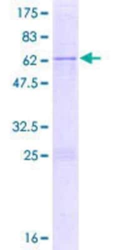 Novus Biologicals&trade;&nbsp;Recombinant Human IMP4 GST (N-Term) Protein