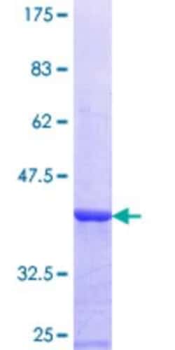 Novus Biologicals Recombinant Human ADAMTSL-1/Punctin GST (N-Term) Protein 25 &mu;g | Buy Online | Novus Biologicals&trade; | Fisher Scientific