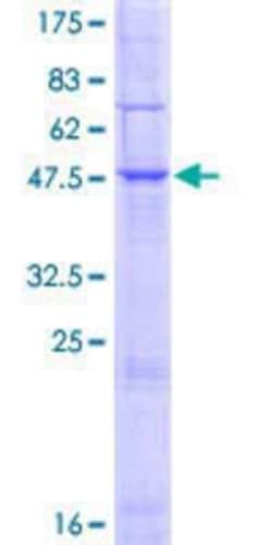 Novus Biologicals&trade;&nbsp;Recombinant Human MARCH9 GST (N-Term) Protein
