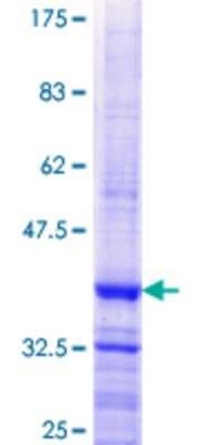 Novus Biologicals Recombinant Human MARCH9 GST (N-Term) Protein 25 &mu;g | Buy Online | Novus Biologicals&trade; | Fisher Scientific