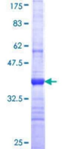Novus Biologicals Recombinant Human PKHD1L1 GST (N-Term) Protein 10 &mu;g | Buy Online | Novus Biologicals&trade; | Fisher Scientific