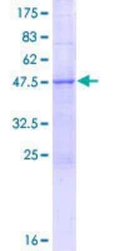 Novus Biologicals Recombinant Human TEX30 GST (N-Term) Protein 25 &mu;g | Buy Online | Novus Biologicals&trade; | Fisher Scientific