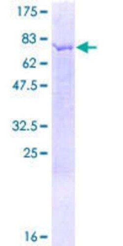 Novus Biologicals&trade;&nbsp;Recombinant Human NAPRT1 GST (N-Term) Protein