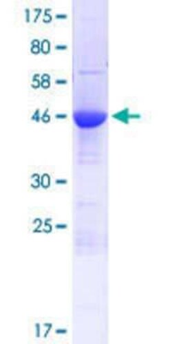 Novus Biologicals Recombinant Human SYCE1 GST (N-Term) Protein 10 &mu;g | Buy Online | Novus Biologicals&trade; | Fisher Scientific