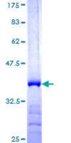 Novus Biologicals Recombinant Human FBXO44 GST (N-Term) Protein 25 &mu;g | Buy Online | Novus Biologicals&trade; | Fisher Scientific