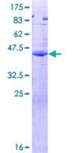 Novus Biologicals&trade;&nbsp;Recombinant Human CGB5 GST (N-Term) Protein