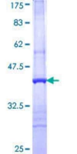 Novus Biologicals Recombinant Human CAPZA3 GST (N-Term) Protein 10 &mu;g | Buy Online | Novus Biologicals&trade; | Fisher Scientific