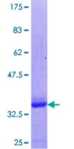 Novus Biologicals Recombinant Human FoxP2 GST (N-Term) Protein 10 &mu;g | Buy Online | Novus Biologicals&trade; | Fisher Scientific