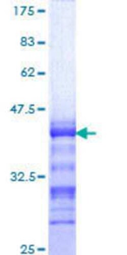 Novus Biologicals Recombinant Human FoxP2 GST (N-Term) Protein 25 &mu;g | Buy Online | Novus Biologicals&trade; | Fisher Scientific