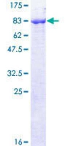 Novus Biologicals Recombinant Human PIGS GST (N-Term) Protein 25 &mu;g | Buy Online | Novus Biologicals&trade; | Fisher Scientific