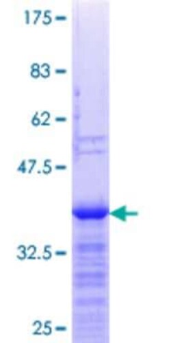 Novus Biologicals Recombinant Human ZNF101 GST (N-Term) Protein 25 &mu;g | Buy Online | Novus Biologicals&trade; | Fisher Scientific