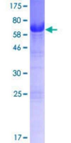 Novus Biologicals Recombinant Human SYAP1 GST (N-Term) Protein 10 &mu;g | Buy Online | Novus Biologicals&trade; | Fisher Scientific
