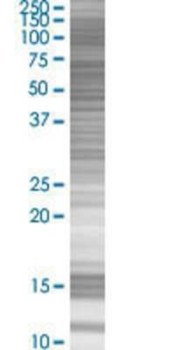 Novus Biologicals&trade;&nbsp;GCFC1 293T Cell Transient Overexpression Lysate