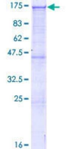 Novus Biologicals Recombinant Human ARHGAP12 GST (N-Term) Protein 25 &mu;g | Buy Online | Novus Biologicals&trade; | Fisher Scientific