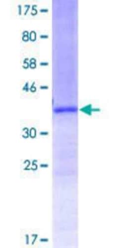 Novus Biologicals Recombinant Human FOXQ1 GST (N-Term) Protein 10 &mu;g | Buy Online | Novus Biologicals&trade; | Fisher Scientific
