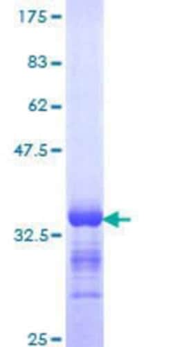 Novus Biologicals Recombinant Human GNG8 GST (N-Term) Protein 25 &mu;g | Buy Online | Novus Biologicals&trade; | Fisher Scientific