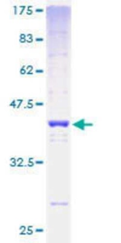 Novus Biologicals Recombinant Human H2AFV GST (N-Term) Protein 2 &mu;g | Buy Online | Novus Biologicals&trade; | Fisher Scientific