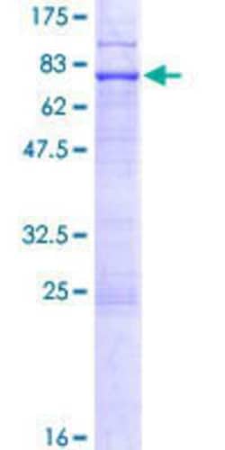 Novus Biologicals Recombinant Human Epithelial Stromal Interaction 1 GST (N-Term) Protein 10 &mu;g | Buy Online | Novus Biologicals&trade; | Fisher Scientific