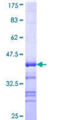 Novus Biologicals Recombinant Human Epithelial Stromal Interaction 1 GST (N-Term) Protein 10 &mu;g | Buy Online | Novus Biologicals&trade; | Fisher Scientific