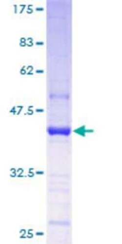 Novus Biologicals Recombinant Human PIMT GST (N-Term) Protein 10 &mu;g | Buy Online | Novus Biologicals&trade; | Fisher Scientific