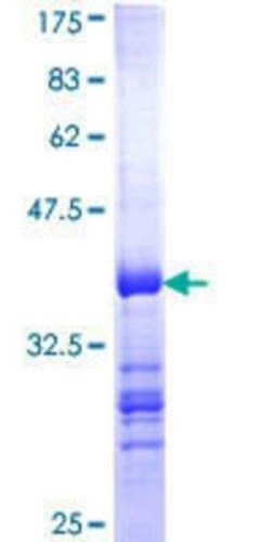Novus Biologicals Recombinant Human BIRC8 GST (N-Term) Protein 25 &mu;g | Buy Online | Novus Biologicals&trade; | Fisher Scientific