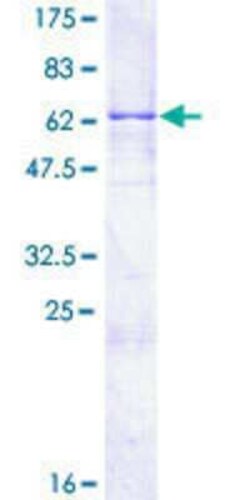 Novus Biologicals Recombinant Human PRKCDBP GST (N-Term) Protein 25 &mu;g | Buy Online | Novus Biologicals&trade; | Fisher Scientific