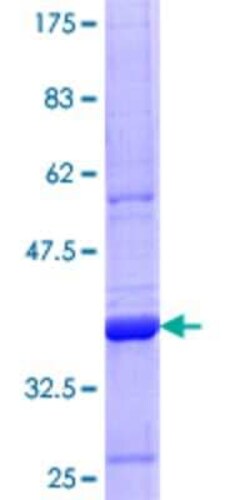 Novus Biologicals Recombinant Human Cytokeratin 71 GST (N-Term) Protein 25 &mu;g | Buy Online | Novus Biologicals&trade; | Fisher Scientific