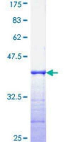 Novus Biologicals Recombinant Human PRPK GST (N-Term) Protein 25 &mu;g | Buy Online | Novus Biologicals&trade; | Fisher Scientific
