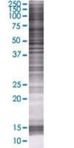 Novus Biologicals DNA helicase HEL308 293T Cell Transient Overexpression Lysate 0.1 mL | Buy Online | Novus Biologicals&trade; | Fisher Scientific