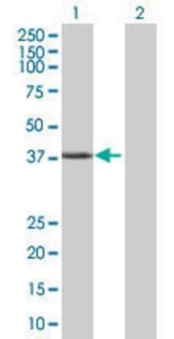 Novus Biologicals DNA helicase HEL308 293T Cell Transient Overexpression Lysate 0.1 mL | Buy Online | Novus Biologicals&trade; | Fisher Scientific