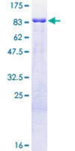 Novus Biologicals Recombinant Human TRIM9 GST (N-Term) Protein 10 &mu;g | Buy Online | Novus Biologicals&trade; | Fisher Scientific