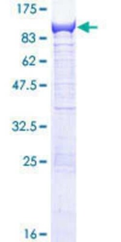 Novus Biologicals Recombinant Human EFHC1 GST (N-Term) Protein 25 &mu;g | Buy Online | Novus Biologicals&trade; | Fisher Scientific