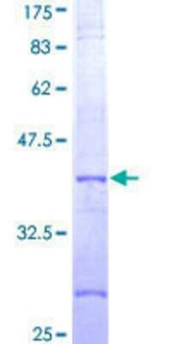 Novus Biologicals Recombinant Human NLRP3/NALP3 GST (N-Term) Protein 25 &mu;g | Buy Online | Novus Biologicals&trade; | Fisher Scientific